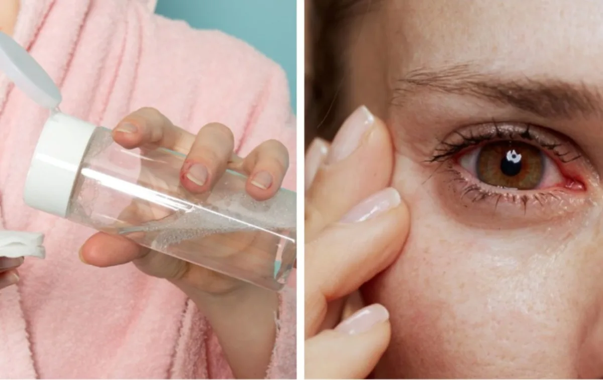 Відкликання Simple Kind to Skin в Україні: які партії небезпечні